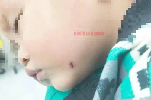 https://tinhot24h.vercel.app/bao-mau-danh-tre-da-man-o-quang-nam-quen-tat-camera-phu-huynh-moi-phat-hien.html